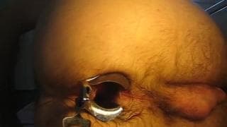 Ele gosta de abrir a bunda com espéculo para meter um dildo!